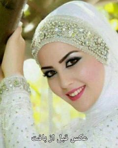 نمونه عکس قبل از بافت